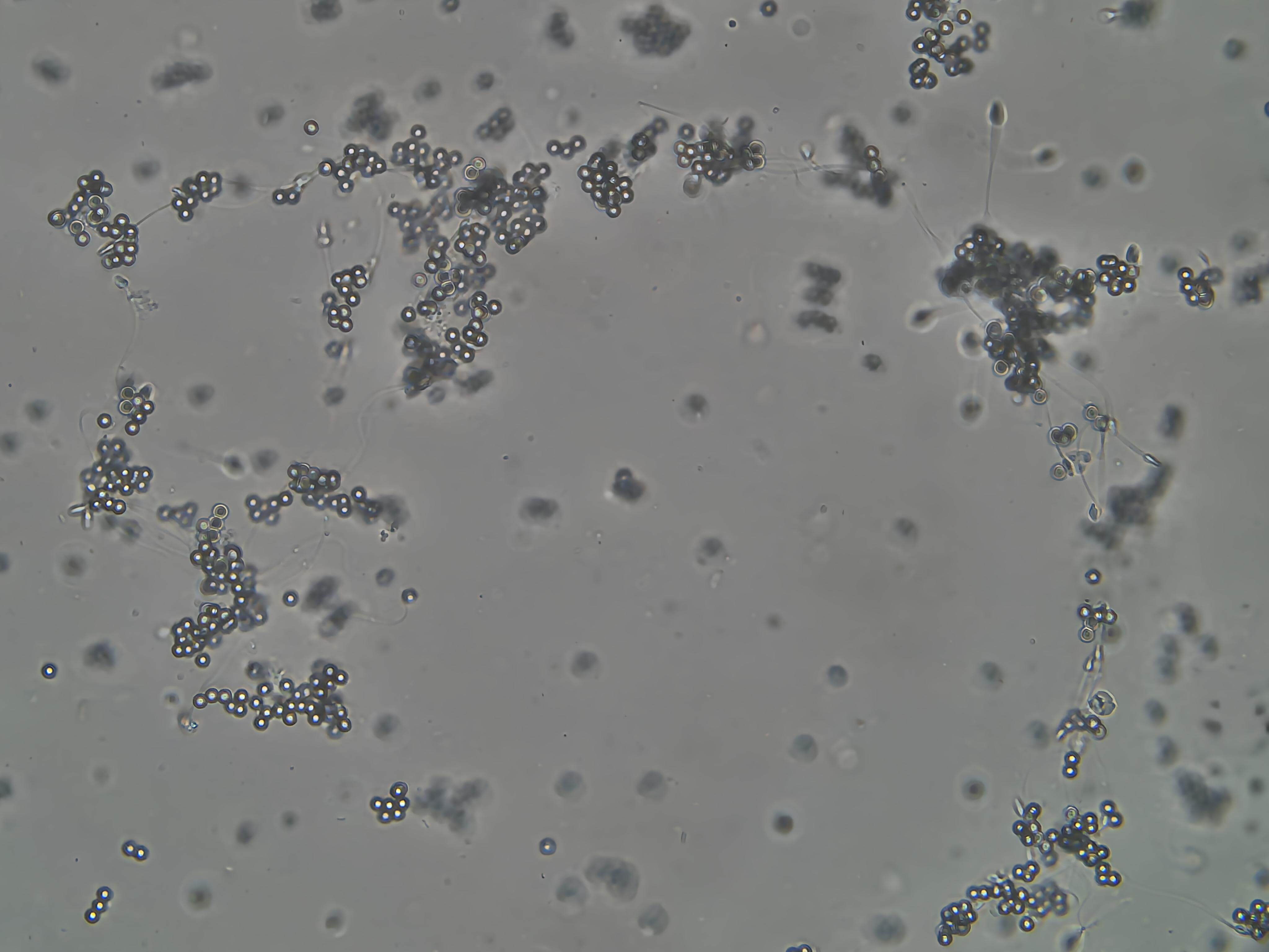 Sperm MAR test kit for detecting anti-sperm antibodies